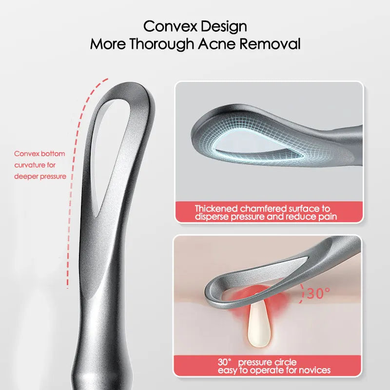 Blackhead Remover Acne Tool Kit – Pimple Extractor Needles, Tweezers & Deep Pore Cleaning Set