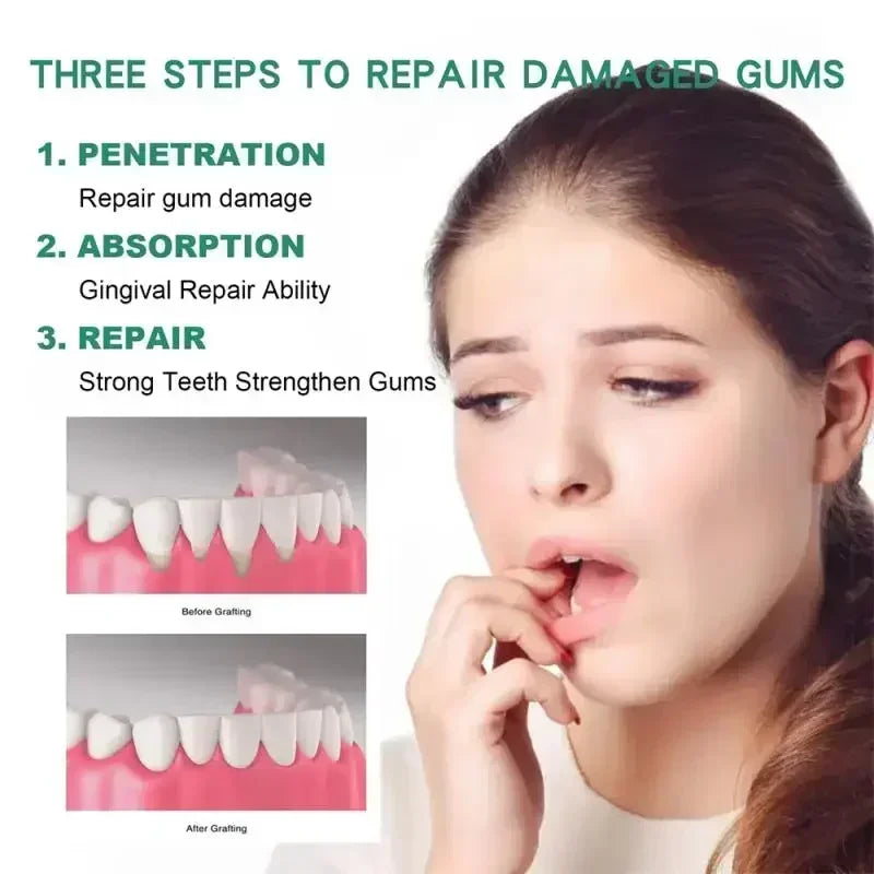 30ml Gingival Repair Drops – Fast Treatment for Cavities, Receding Gums & Gum Pain Relief