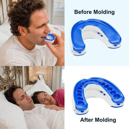 Adjustable Anti-Snoring Mouth Guard – Night Mouthpiece for Bruxism and Sleep Aid Snoring Relief