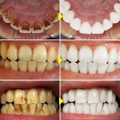 SP-10 Fresh Breath & Whitening Toothpaste – Removes Plaque, Yellow Stains & Supports Gum Health for Oral Care