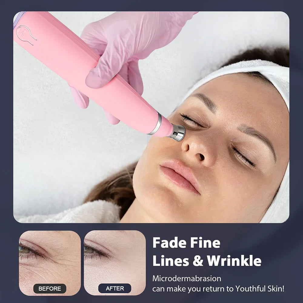 Professional Diamond Microdermabrasion Machine – At-Home Facial Peeling & Deep Cleaning Skin Care Tool