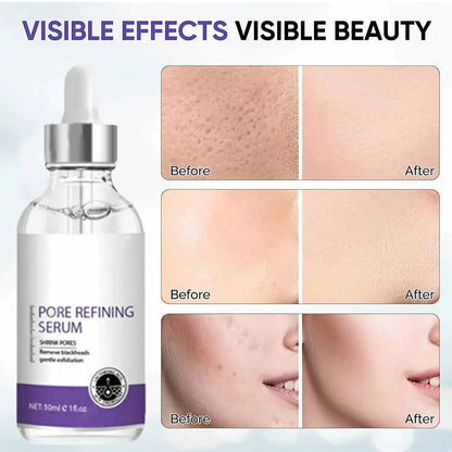 Pore Shrinking Serum – Facial Essence for Large Pore Removal, Tightening, Repairing, and Firming Skin Care