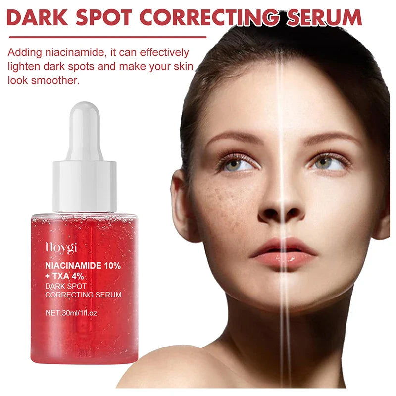 Niacinamide Serum – Dark Spot Correcting, Moisturizing & Brightening, Fades Fine Lines, Deep Cleansing Korean Skincare
