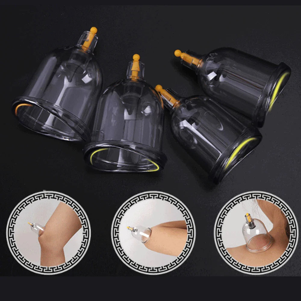 12/24-Cup Chinese Vacuum Cupping Therapy Set – Pull-Out Suction Massager for Pain Relief & Muscle Relaxation