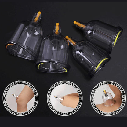 12/24-Cup Chinese Vacuum Cupping Therapy Set – Pull-Out Suction Massager for Pain Relief & Muscle Relaxation