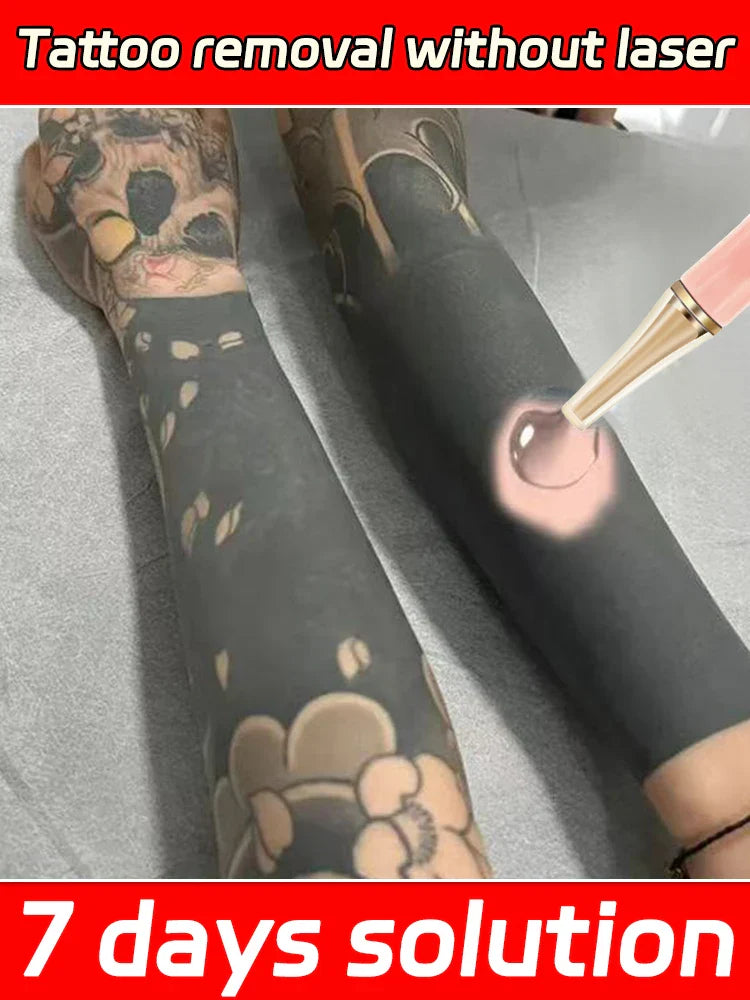 Quick Tattoo Removal Cream – Effective for Pigmented & Permanent Makeup Tattoo Removal