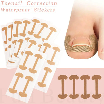 Ingrown Nail Correction Stickers - 40/100/200pcs Toenail Corrector Patches for Paronychia Treatment and Pedicure Recovery