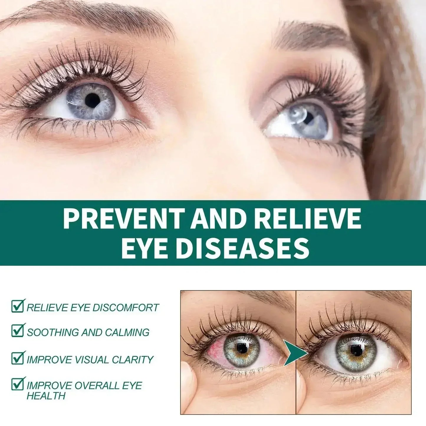 Vision Enhance Roller – Clearer Eyesight, Mild Relaxation Massage for Eye Fatigue, Dryness & Discomfort Relief
