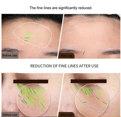 EMS Facial & Body RF Machine – Professional Radio Frequency Beauty Device for Skin Tightening, Face Lifting, and Anti-Aging Home Care