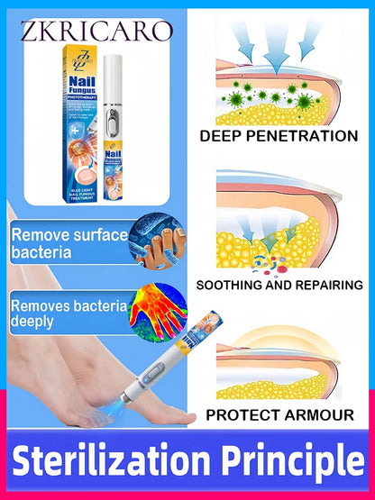 2025 Nail Cleaning Tools – 2nd Gen Blue Light Laser Root Repair Device