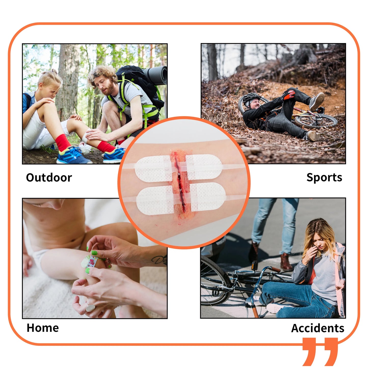 RHINO RESCUE Zip Stitch — Wound Closure Strips, Adhesive Bandages for Cut Care Without Sutures