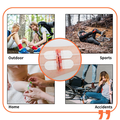 RHINO RESCUE Zip Stitch — Wound Closure Strips, Adhesive Bandages for Cut Care Without Sutures