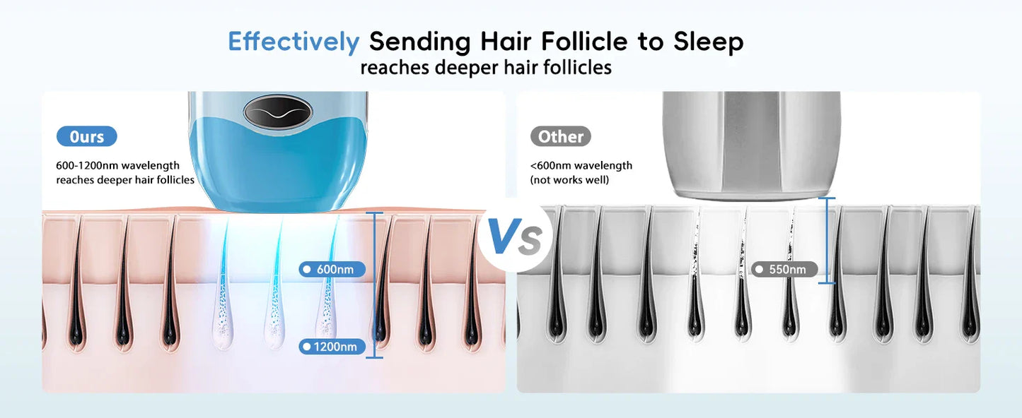 IPL Hair Removal Laser 22J — Unlimited Flashes IGBT, 5.2cm² Light Painless Epilator for Face, Armpit & Bikini Body Treatment