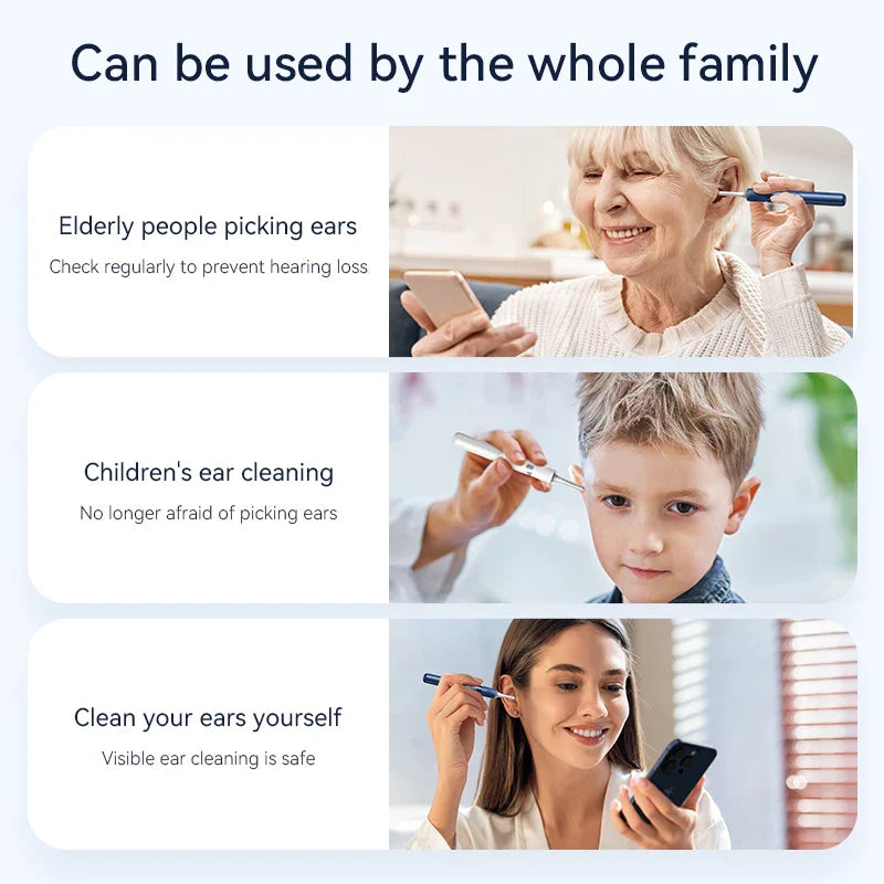 Visual Ear Cleaner with Camera – 12MP Ear Wax Removal Tool with Ear Pick, Tweezers & 6 Ear Spoons for Ear Care