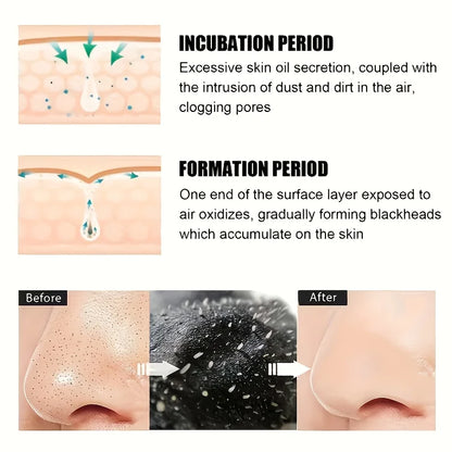Alcohol-Free Nose Cleansing Strips - Deep-Cleansing Pore Patches for Excess Oil & Refined Skin