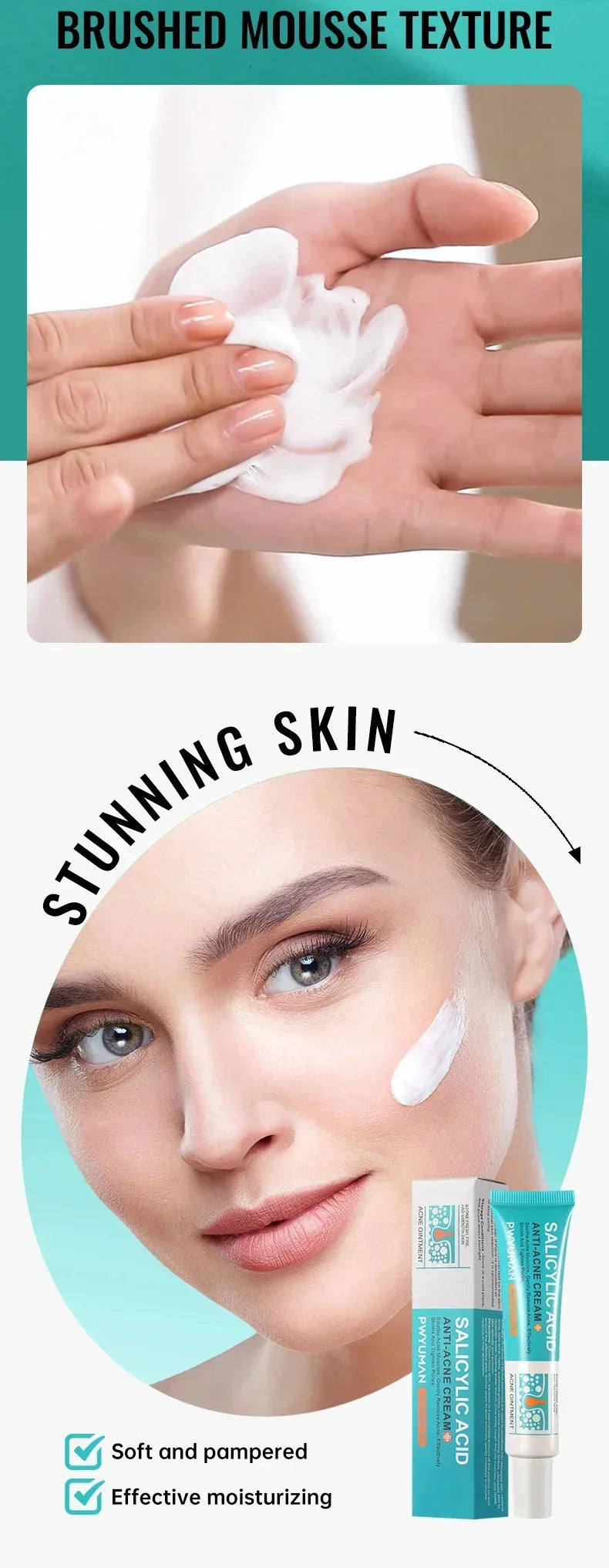 Effective Acne Removal Cream – Anti-Acne Gel for Redness, Pimples, Deep Pore Cleaning & Oil Control Skin Care