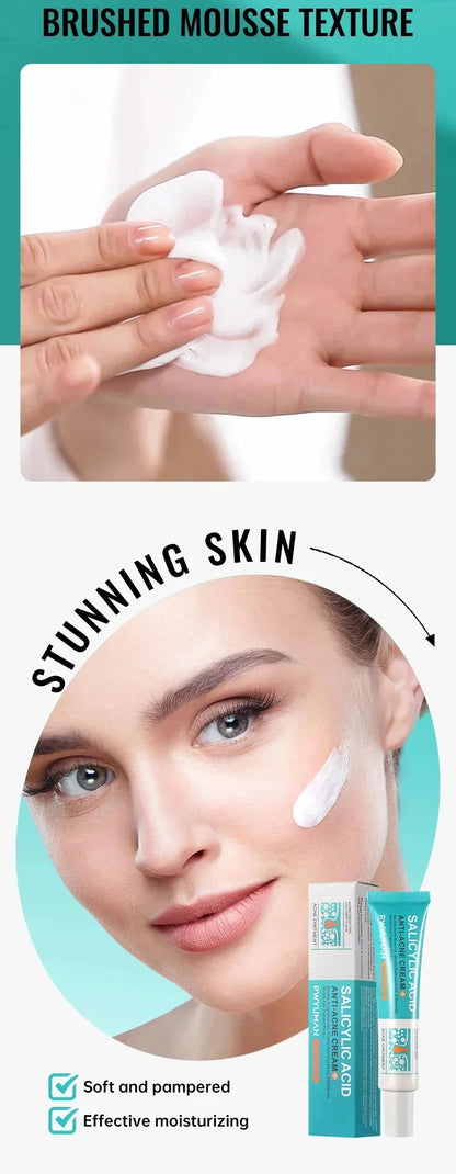 Effective Acne Removal Cream – Anti-Acne Gel for Redness, Pimples, Deep Pore Cleaning & Oil Control Skin Care