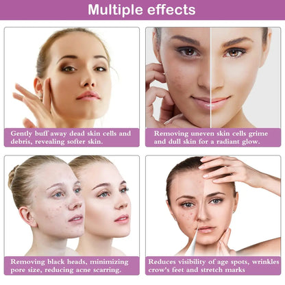 Diamond Microdermabrasion Machine – 65-68cmHg Suction Professional Facial Skin Care Equipment for Home Use