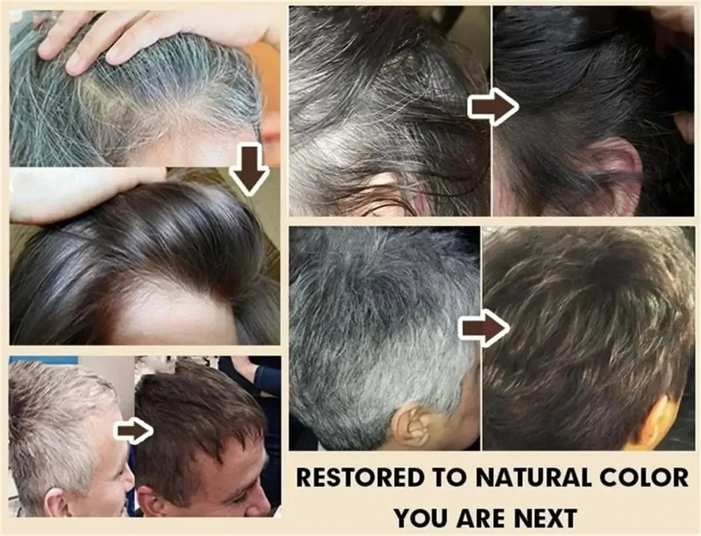 White Hair Remover – Restore Natural Hair Color in 7 Days, Gray Hair Treatment Solution