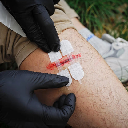 RHINO RESCUE Zip Stitch Laceration Closure Kit — Wound Closure Strips with Dressings, Suture-Free Care
