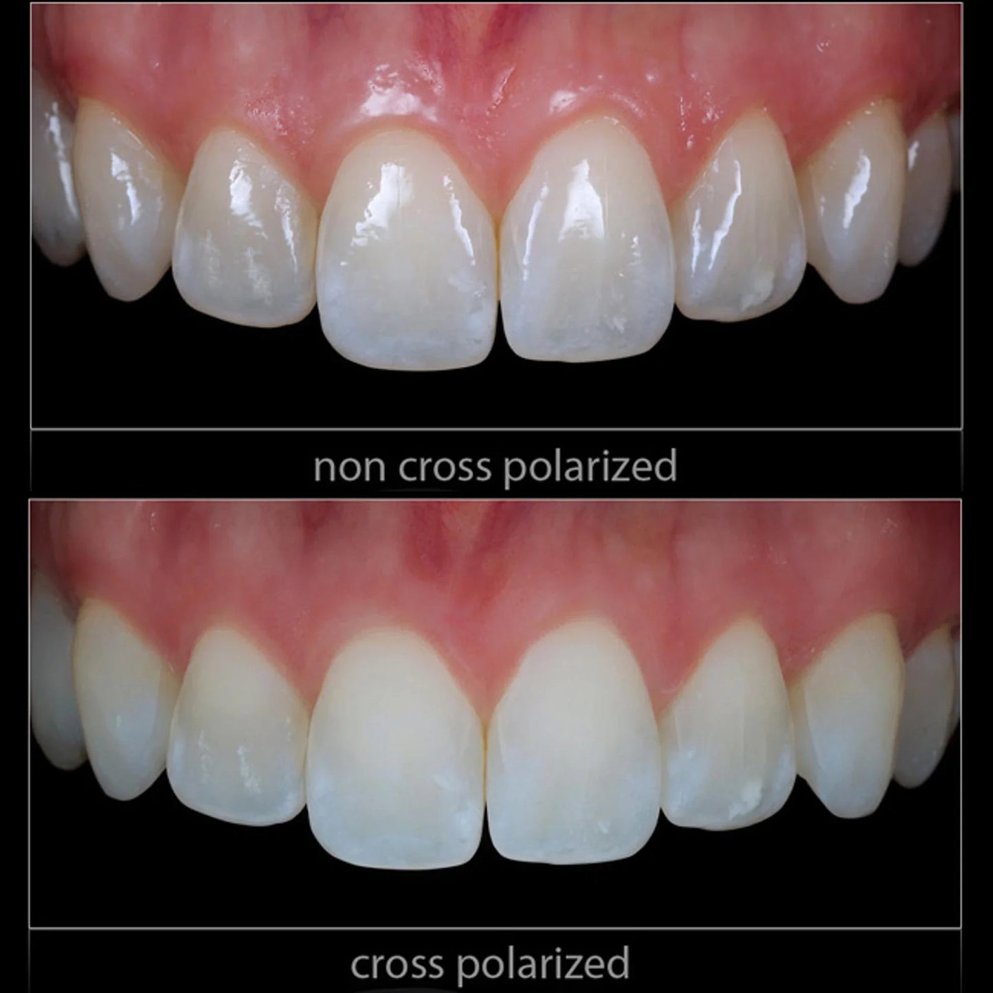 Godox MF12 Dental Photography Polarizer Kit Cross-Polarization Flash Set for Reflection-Free Intraoral & Clinical Imaging