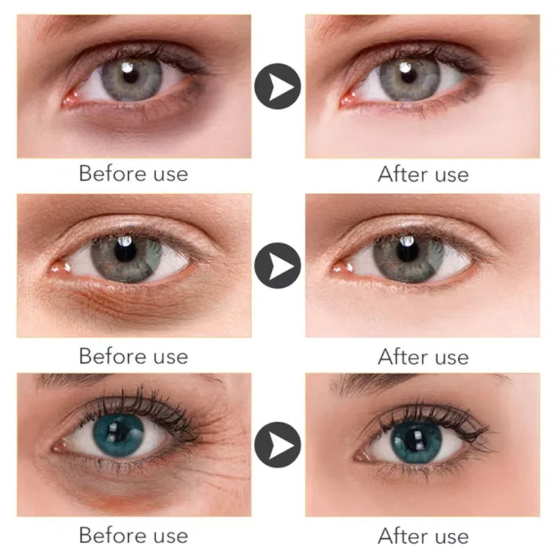 Anti-Dark Circle Eye Serum — Retinol Oil for Wrinkle Removal, Firming, Eye Bag Reduction, Fine Line Fading & Brightening Korean Eye Care