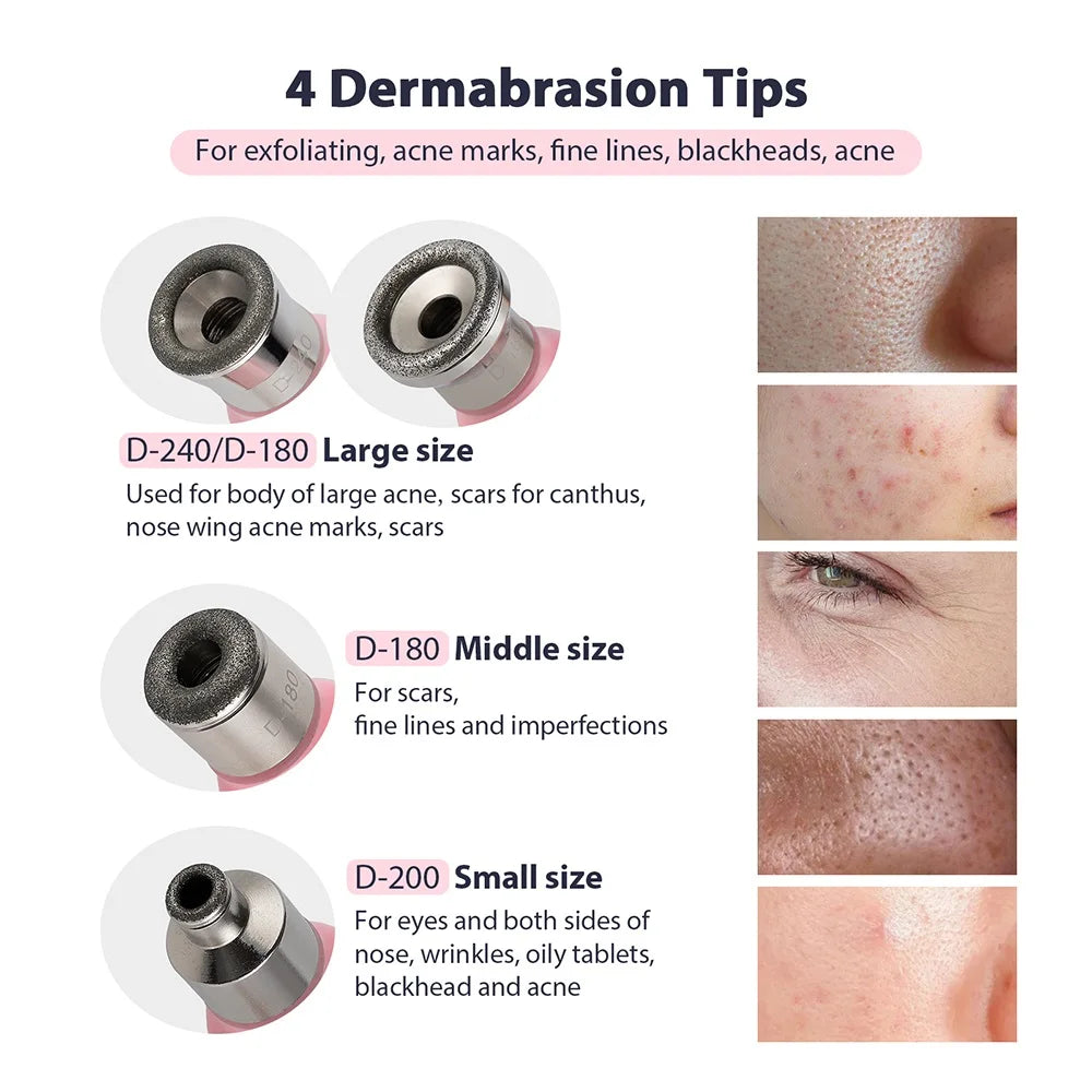 Professional Diamond Microdermabrasion Machine – At-Home Facial Peeling & Deep Cleaning Skin Care Tool