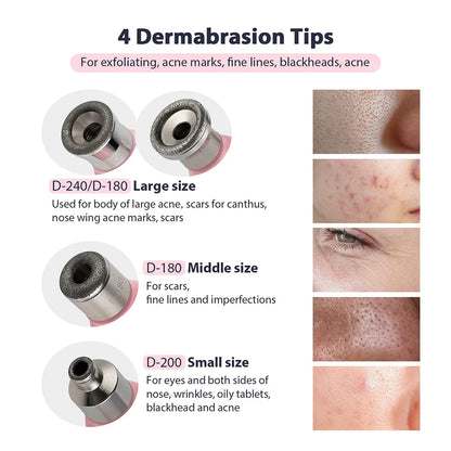 Professional Diamond Microdermabrasion Machine – At-Home Facial Peeling & Deep Cleaning Skin Care Tool