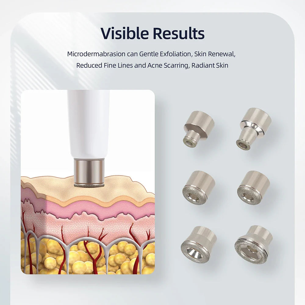 Professional Diamond Microdermabrasion Machine – At-Home Facial Peeling & Deep Cleaning Skin Care Tool
