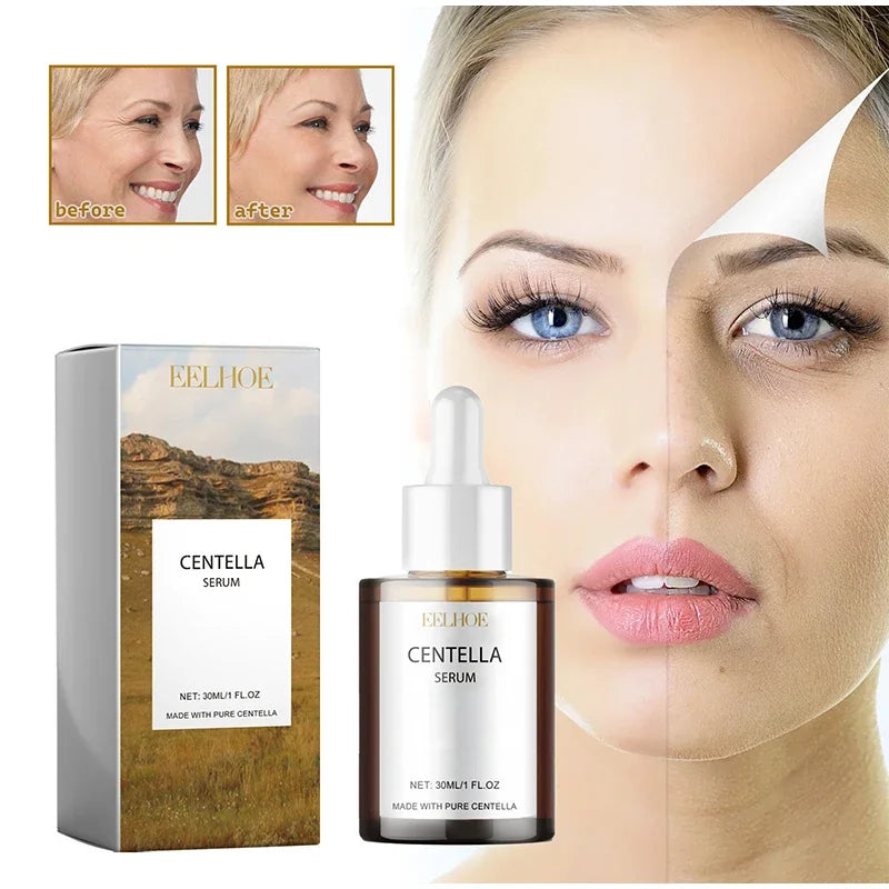 Centella Asiatica Face Serum – Nourishing, Brightening & Moisturizing Cream for Dry Skin Rejuvenation