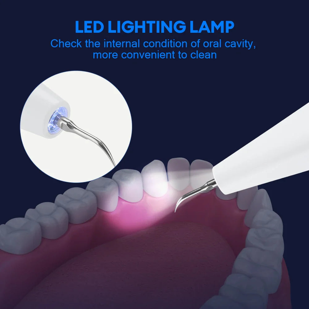 Ultrasonic Dental Scaler – Tartar Removal, Calculus Remover, Tooth Stain Cleaner with LED Light, Tooth Whitening Tools for Household Use