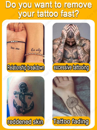 Tattoo Removal Spray — Fast-Acting Formula Removes Tattoos in 7 Days