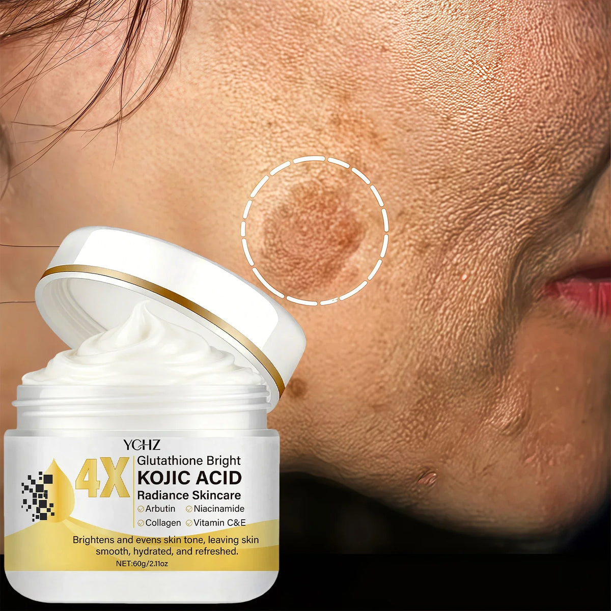 Kojic Acid Face Cream - Dark Spot Correcting Moisturizer for Even Skin Tone, Day & Night Use, 60g