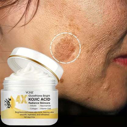 Kojic Acid Face Cream - Dark Spot Correcting Moisturizer for Even Skin Tone, Day & Night Use, 60g
