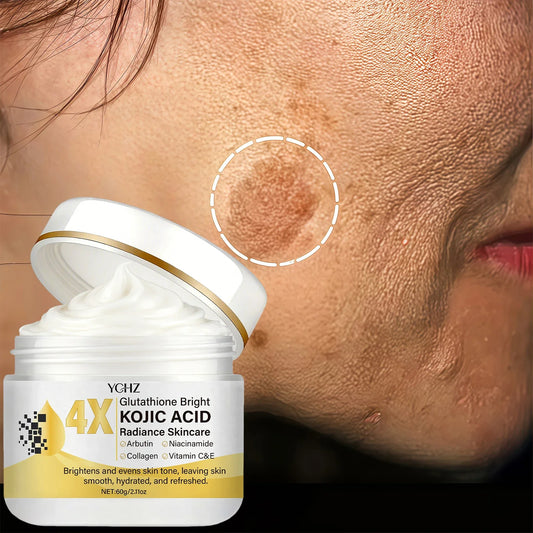 Kojic Acid Face Cream - Dark Spot Correcting Moisturizer for Even Skin Tone, Day & Night Use, 60g