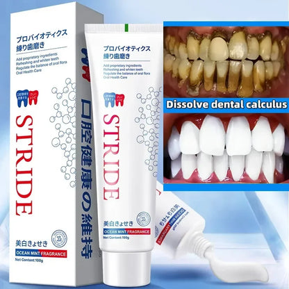 Dental Calculus Remover – Bad Breath & Whitening Teeth Care, Prevent Periodontitis & Brighten Smile