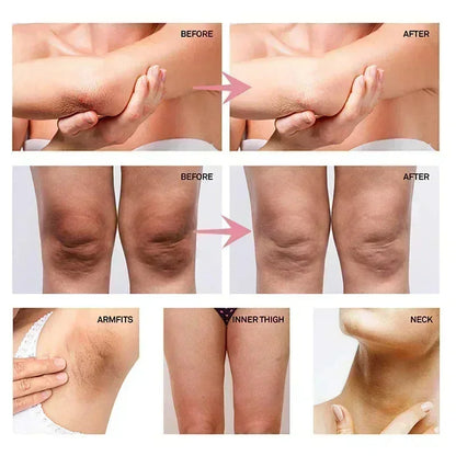 Whitening Cream for Underarms, Knees & Inner Thighs – Brightening Moisturizing Body Serum for Even Skin Tone Care