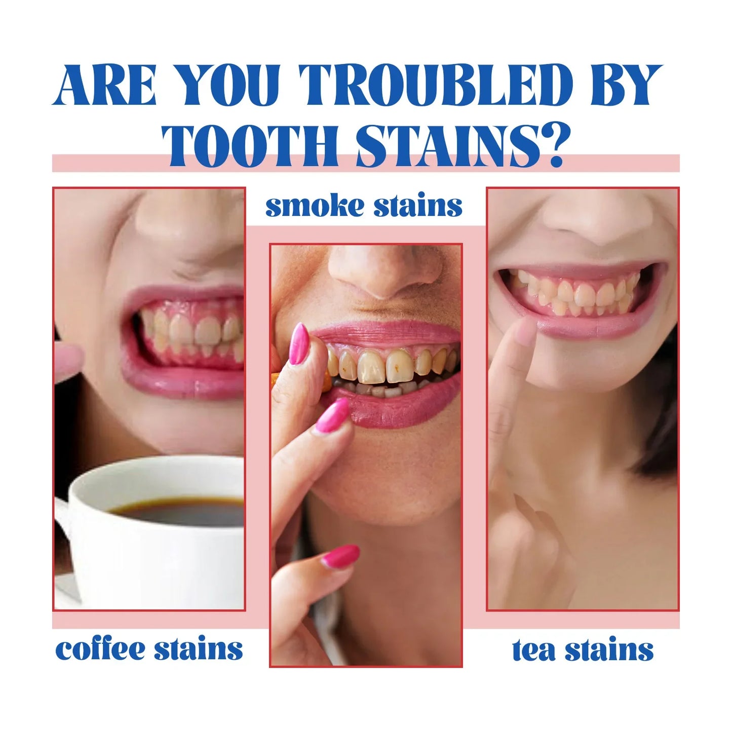 SP6 Probiotic Whitening Toothpaste – Stain Removal, Fresh Breath & Yellow Teeth Reduction for Daily Oral Care