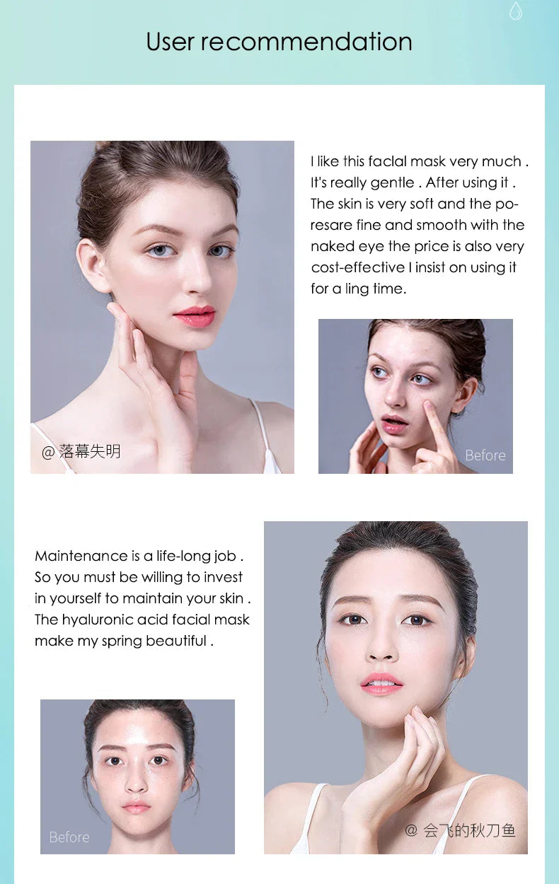 10pcs Hyaluronic Acid Hydrating Facial Mask – Moisturizing, Pore Shrinking Skin Care Face Masks