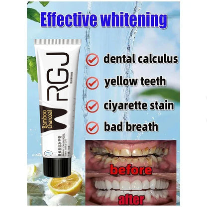 Dental Calculus Remover & Whitening Toothpaste – Fresh Breath & Periodontitis Prevention