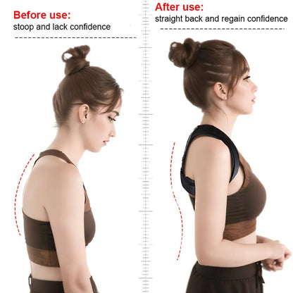 Adjustable Unisex Posture Corrector: Clavicle Support for Neck, Back & Shoulders - Pain Relief & Body Reshaping Solution (1PC)
