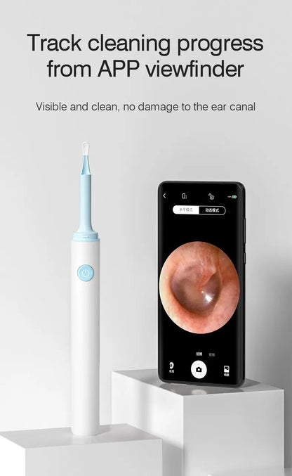 Wireless Visual Ear Endoscope Camera – 5MP Ear Cleaning Tools with Safe Silicone Earpick, Luminous Otoscope & Ear Wax Remover