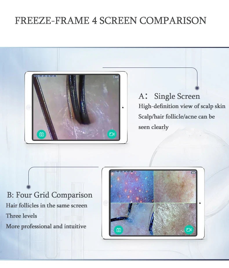 WiFi HD 5G Scalp, Skin & Hair Follicle Detector – 50X/200X Rechargeable UV Skin Analyzer Magnifier