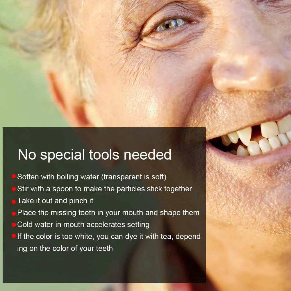 Temporary Tooth Repair Beads – Dental Filling Material for Broken or Missing Teeth