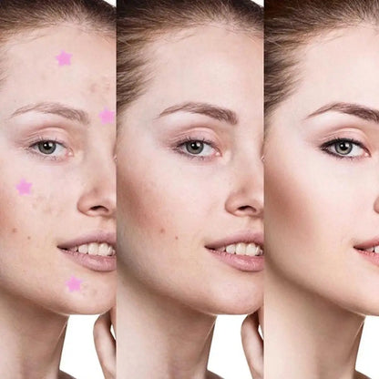 72pcs Invisible Anti-Acne Pimple Patches – Hydrocolloid Waterproof Spot & Mark Repair Stickers