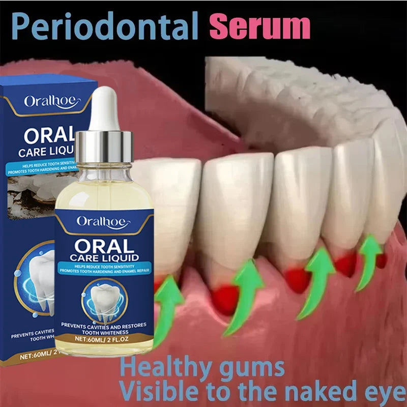 60ML Gum Repair Gel Serum - Sore Gum Relief Dental Care for Teeth Cleaning, Stains, Tartar & Oral Health