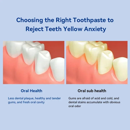 Dental Calculus Remover – Bad Breath & Whitening Teeth Care, Prevent Periodontitis & Brighten Smile