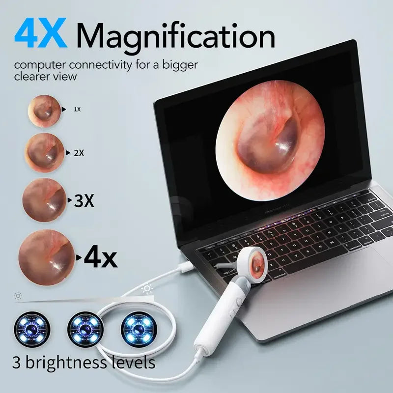 Smart Ear Camera Endoscope – 1080P HD Ear Cleaning Tool with 90° Rotatable Lens & 12 Replacement Heads for Ear, Nose & Skin Inspection