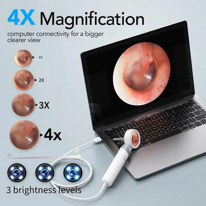 Smart Ear Camera Endoscope – 1080P HD Ear Cleaning Tool with 90° Rotatable Lens & 12 Replacement Heads for Ear, Nose & Skin Inspection