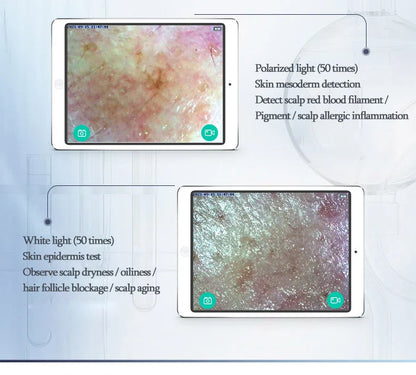 New WiFi HD 5G Scalp & Skin Hair Follicle Detector - Professional 50X/200X Rechargeable UV Skin Analyzer Magnifier